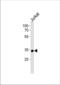 Small Nuclear RNA Activating Complex Polypeptide 2 antibody, TA324597, Origene, Western Blot image 