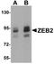 Zinc Finger E-Box Binding Homeobox 2 antibody, orb94544, Biorbyt, Western Blot image 