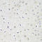Importin subunit alpha-3 antibody, A06131-1, Boster Biological Technology, Immunohistochemistry paraffin image 