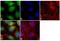 Filaggrin antibody, MA5-13440, Invitrogen Antibodies, Immunofluorescence image 