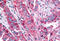 Adhesion G Protein-Coupled Receptor B2 antibody, MBS244848, MyBioSource, Immunohistochemistry frozen image 