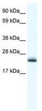 Tubulin Polymerization Promoting Protein antibody, TA331429, Origene, Western Blot image 