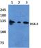 Diacylglycerol Kinase Delta antibody, PA5-75256, Invitrogen Antibodies, Western Blot image 