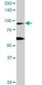 Ras And Rab Interactor 1 antibody, H00009610-D01P, Novus Biologicals, Western Blot image 