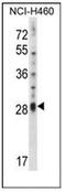 Interleukin 17D antibody, AP52187PU-N, Origene, Western Blot image 