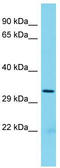 Ribosome Production Factor 2 Homolog antibody, TA342971, Origene, Western Blot image 