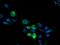 Cytochrome P450 Family 2 Subfamily B Member 6 antibody, MA5-25882, Invitrogen Antibodies, Immunocytochemistry image 