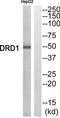 D(1A) dopamine receptor antibody, TA311805, Origene, Western Blot image 