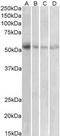 Solute Carrier Family 18 Member A2 antibody, MBS421308, MyBioSource, Western Blot image 