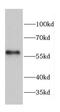 Chaperonin Containing TCP1 Subunit 7 antibody, FNab01403, FineTest, Western Blot image 