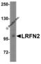 Leucine Rich Repeat And Fibronectin Type III Domain Containing 2 antibody, 5067, ProSci, Western Blot image 