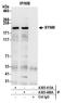 Synemin antibody, A305-468A, Bethyl Labs, Immunoprecipitation image 