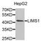 LIM Zinc Finger Domain Containing 1 antibody, abx004882, Abbexa, Western Blot image 