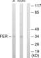 FER Tyrosine Kinase antibody, LS-C118794, Lifespan Biosciences, Western Blot image 