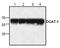 Diacylglycerol O-acyltransferase 1 antibody, TA318979, Origene, Western Blot image 