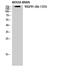 Fms Related Tyrosine Kinase 1 antibody, STJ93094, St John