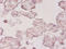 HMG-CoA reductase antibody, A52932-100, Epigentek, Immunohistochemistry paraffin image 