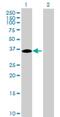 Chromosome 16 Open Reading Frame 78 antibody, H00123970-B01P, Novus Biologicals, Western Blot image 