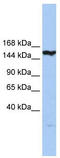 Caspase 8 Associated Protein 2 antibody, TA339709, Origene, Western Blot image 