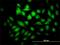 Pyrroline-5-Carboxylate Reductase 3 antibody, H00065263-M01, Novus Biologicals, Immunocytochemistry image 