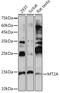 MT2 antibody, GTX00789, GeneTex, Western Blot image 