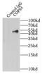 COP9 Signalosome Subunit 4 antibody, FNab01872, FineTest, Immunoprecipitation image 
