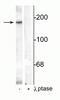 Glutamate Ionotropic Receptor NMDA Type Subunit 2B antibody, P01883-2, Boster Biological Technology, Western Blot image 