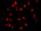Bromodomain Containing 2 antibody, A302-582A, Bethyl Labs, Immunofluorescence image 