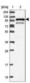 Leucine-, glutamate- and lysine-rich protein 1 antibody, NBP1-93995, Novus Biologicals, Western Blot image 