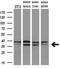 Microtubule Associated Protein RP/EB Family Member 2 antibody, M06859-1, Boster Biological Technology, Western Blot image 