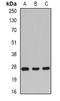 Rac Family Small GTPase 1 antibody, orb341337, Biorbyt, Western Blot image 