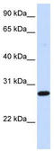 Deoxycytidine kinase antibody, TA339942, Origene, Western Blot image 