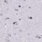 Histone Cluster 1 H1 Family Member T antibody, PA5-66983, Invitrogen Antibodies, Immunohistochemistry frozen image 
