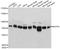 Nucleoporin 93 antibody, A4333, ABclonal Technology, Western Blot image 