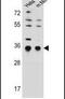 Signal Sequence Receptor Subunit 1 antibody, PA5-11502, Invitrogen Antibodies, Western Blot image 