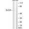 SV2 Related Protein antibody, A15475, Boster Biological Technology, Western Blot image 