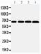 Growth Factor Receptor Bound Protein 10 antibody, PA1580-1, Boster Biological Technology, Western Blot image 