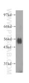 Inositol-Pentakisphosphate 2-Kinase antibody, 12603-1-AP, Proteintech Group, Western Blot image 