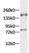 Microtubule Associated Protein Tau antibody, MN1000, Invitrogen Antibodies, Western Blot image 