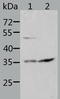 Suppressor Of Cytokine Signaling 1 antibody, TA321593, Origene, Western Blot image 