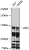 Discoidin Domain Receptor Tyrosine Kinase 1 antibody, 13-682, ProSci, Western Blot image 