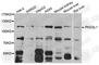 Polycystin 2 Like 1, Transient Receptor Potential Cation Channel antibody, A8172, ABclonal Technology, Western Blot image 