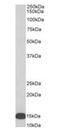 Arachidonate 5-Lipoxygenase Activating Protein antibody, orb389355, Biorbyt, Western Blot image 