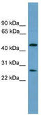 Elongator Acetyltransferase Complex Subunit 4 antibody, TA329925, Origene, Western Blot image 