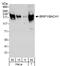 BRCA1 Interacting Protein C-Terminal Helicase 1 antibody, A300-561A, Bethyl Labs, Western Blot image 