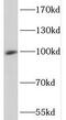 Nuclear autoantigen Sp-100 antibody, FNab08132, FineTest, Western Blot image 