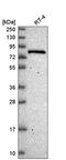 RBM35B antibody, HPA048618, Atlas Antibodies, Western Blot image 