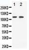 Ephrin type-B receptor 3 antibody, PA5-79211, Invitrogen Antibodies, Western Blot image 