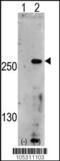 Phosphoinositide Kinase, FYVE-Type Zinc Finger Containing antibody, 62-704, ProSci, Western Blot image 