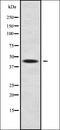 Calcium Homeostasis Endoplasmic Reticulum Protein antibody, orb338092, Biorbyt, Western Blot image 